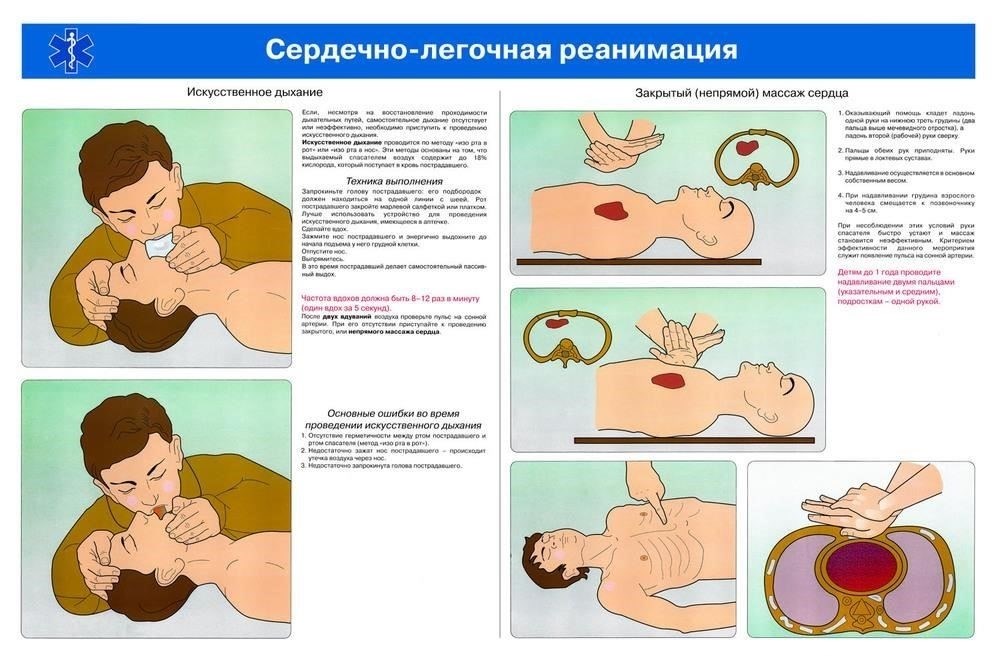 Как делать искусственное дыхание пострадавшему после аварии